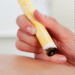 Moxibustion